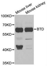 Western blot analysis of extracts of various tissues, using BTD antibody.