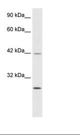 Jurkat Cell Lysate.