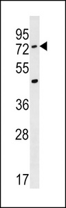 ACSM2A Antibody western blot of A549 cell line lysates (35 ug/lane). The ACSM2A antibody detected the ACSM2A protein (arrow).
