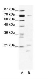 A: Marker, B: Jurkat Cell Lysate