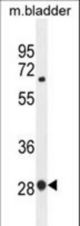 BTF3 Antibody western blot of mouse bladder tissue lysates (35 ug/lane). The BTF3 antibody detected the BTF3 protein (arrow).