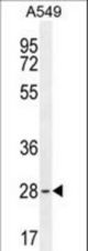 BTF3 Antibody western blot of A549 cell line lysates (35 ug/lane). The BTF3 antibody detected the BTF3 protein (arrow).
