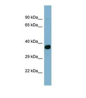 Western blot of Human NCI-H226 Whole cell . ACSM2A antibody dilution 1.0 ug/ml.