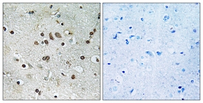 IHC of paraffin-embedded human brain tissue, using BTF3L4 Antibody. The sample on the right was incubated with synthetic peptide.