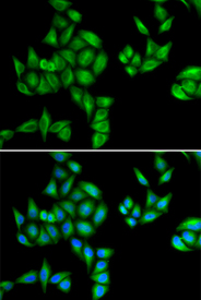 Immunofluorescence analysis of HeLa cell using BTG1 antibody. Blue: DAPI for nuclear staining.