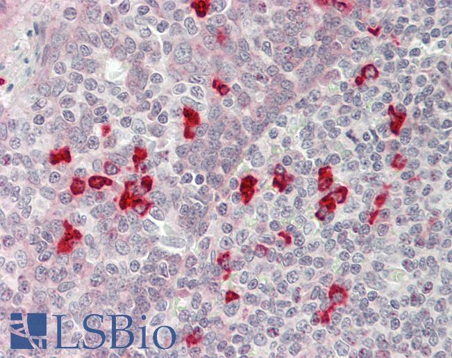 Human Tonsil: Formalin-Fixed, Paraffin-Embedded (FFPE)