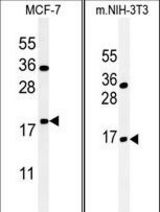 (LEFT)Western blot of BTG1 Antibody in MCF-7 cell line lysates (35 ug/lane). BTG1 (arrow) was detected using the purified antibody.(RIGHT)Western blot of BTG1 Antibody in mouse NIH-3T3 tissue lysates (35 ug/lane). BTG1 (arrow) was detected using the purified antibody.