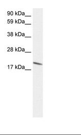 Fetal Lung Lysate