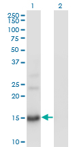 Western Blot analysis of BTG2 expression in transfected 293T cell line by BTG2 monoclonal antibody (M01), clone 1A5.Lane 1: BTG2 transfected lysate(17.4 KDa).Lane 2: Non-transfected lysate.