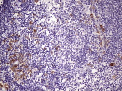 IHC of paraffin-embedded Human tonsil using anti-BTG2 mouse monoclonal antibody. (Heat-induced epitope retrieval by 1 mM EDTA in 10mM Tris, pH8.5, 120°C for 3min)(1:150).