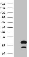HEK293T cells were transfected with the pCMV6-ENTRY control (Left lane) or pCMV6-ENTRY BTG2 (Right lane) cDNA for 48 hrs and lysed. Equivalent amounts of cell lysates (5 ug per lane) were separated by SDS-PAGE and immunoblotted with anti-BTG2 (1:2000).