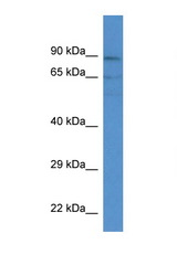 ACSM3 antibody LS-C135509 Western blot of Placenta lysate. Antibody concentration 1 ug/ml.