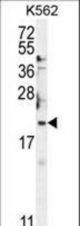 BTG2 Antibody western blot of K562 cell line lysates (35 ug/lane). The BTG2 antibody detected the BTG2 protein (arrow).