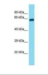 Western blot of Human COLO205. ACSM3 antibody dilution 1.0 ug/ml.