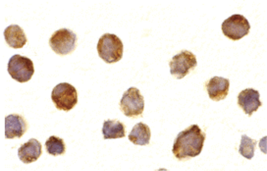 Immunocytochemistry of BTK in Daudi cells with BTK antibody at 10 ug/ml.