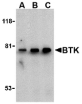Western blot of BTK in U937 cell lysate with BTK antibody at (A) 0.5, (B) 1, and (C) 2 ug/ml.