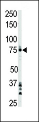 The anti-BTK antibody is used in Western blot to detect BTK in Ramos cell lysate.