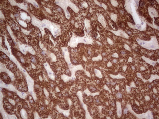 IHC of paraffin-embedded Human liver tissue using anti-ABAT mouse monoclonal antibody. (Heat-induced epitope retrieval by 1 mM EDTA in 10mM Tris, pH8.5, 120°C for 3min).