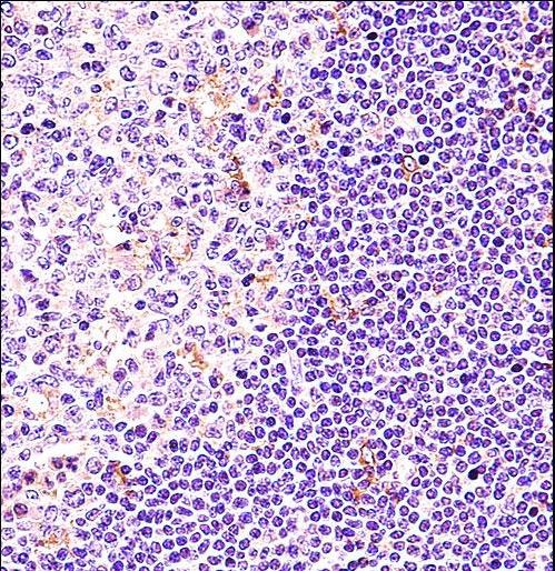 BTK Antibody immunohistochemistry of formalin-fixed and paraffin-embedded human tonsil tissue followed by peroxidase-conjugated secondary antibody and DAB staining.