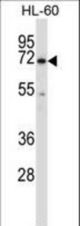 BTK Antibody western blot of HL-60 cell line lysates (35 ug/lane). The BTK antibody detected the BTK protein (arrow).