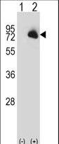 Western blot of BTK (arrow) using rabbit polyclonal BTK Antibody. 293 cell lysates (2 ug/lane) either nontransfected (Lane 1) or transiently transfected (Lane 2) with the BTK gene.