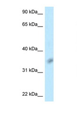 BTLA / CD272 antibody LS-C145939 Western blot of Jurkat Cell lysate. Antibody concentration 1 ug/ml.