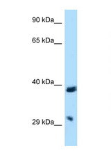 BTLA / CD272 antibody LS-C145359 Western blot of HepG2 Cell lysate. Antibody concentration 1 ug/ml.