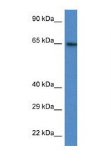 ACSS2 antibody LS-C145618 Western blot of HT1080 Cell lysate. Antibody concentration 1 ug/ml.