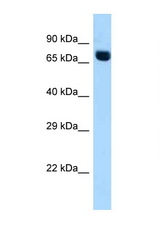 ACSS2 antibody LS-C146046 Western blot of Fetal Heart lysate. Antibody concentration 1 ug/ml.