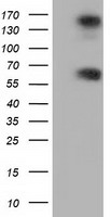 HEK293T cells were transfected with the pCMV6-ENTRY control (Left lane) or pCMV6-ENTRY BTN1A1 (Right lane) cDNA for 48 hrs and lysed. Equivalent amounts of cell lysates (5 ug per lane) were separated by SDS-PAGE and immunoblotted with anti-BTN1A1.