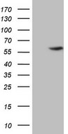 HEK293T cells were transfected with the pCMV6-ENTRY control (Left lane) or pCMV6-ENTRY ABAT (Right lane) cDNA for 48 hrs and lysed. Equivalent amounts of cell lysates (5 ug per lane) were separated by SDS-PAGE and immunoblotted with anti-ABAT.