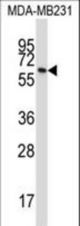 BTN3A1 Antibody western blot of MDA-MB231 cell line lysates (35 ug/lane). The BTN3A1 antibody detected the BTN3A1 protein (arrow).