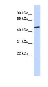 BTNL3 antibody LS-C102249 Western blot of Fetal Lung lysate.