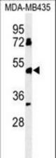 Western blot of BTNL8 Antibody in MDA-MB435 cell line lysates (35 ug/lane). BTNL8 (arrow) was detected using the purified antibody.