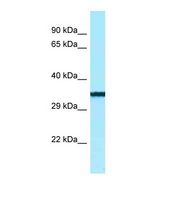 Western blot of Human Jurkat. BTNL9 antibody dilution 1.0 ug/ml.