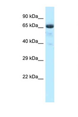 BTRC / bTrCP antibody LS-C145918 Western blot of Rat Lung lysate. Antibody concentration 1 ug/ml.