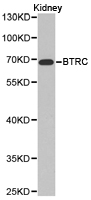 Western blot of extracts of Kidney cell line, using BTRC antibody.