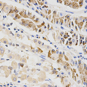 Immunohistochemistry of paraffin-embedded human stomach using BTRC antibody at dilution of 1:200 (x400 lens)