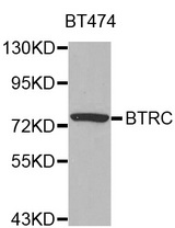 Western blot analysis of extracts of BT474 cell line, using BTRC antibody.