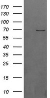 HEK293T cells were transfected with the pCMV6-ENTRY control (Left lane) or pCMV6-ENTRY BTRC (Right lane) cDNA for 48 hrs and lysed. Equivalent amounts of cell lysates (5 ug per lane) were separated by SDS-PAGE and immunoblotted with anti-BTRC.