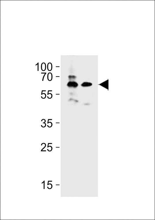 BRTC1/2 Antibody western blot of MDA-MB453,HepG2 cell line lysates (35 ug/lane). The BRTC1/2 antibody detected the BRTC1/2 protein (arrow).
