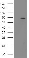 HEK293T cells were transfected with the pCMV6-ENTRY control (Left lane) or pCMV6-ENTRY BTRC (Right lane) cDNA for 48 hrs and lysed. Equivalent amounts of cell lysates (5 ug per lane) were separated by SDS-PAGE and immunoblotted with anti-BTRC.