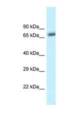 BTRC / bTrCP antibody LS-C145640 Western blot of Mouse Pancreas lysate. Antibody concentration 1 ug/ml.