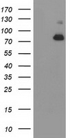 HEK293T cells were transfected with the pCMV6-ENTRY control (Left lane) or pCMV6-ENTRY ACSS2 (Right lane) cDNA for 48 hrs and lysed. Equivalent amounts of cell lysates (5 ug per lane) were separated by SDS-PAGE and immunoblotted with anti-ACSS2.