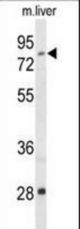 Western blot of ACSS2 Antibody in mouse liver tissue lysates (35 ug/lane). ACSS2 (arrow) was detected using the purified antibody.