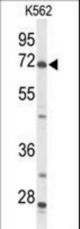 Western blot of ACSS2 Antibody in K562 cell line lysates (35 ug/lane). ACSS2 (arrow) was detected using the purified antibody.