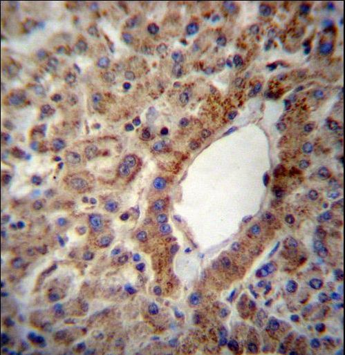 ACSS2 Antibody immunohistochemistry of formalin-fixed and paraffin-embedded human liver tissue followed by peroxidase-conjugated secondary antibody and DAB staining.