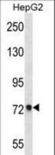 ACSS2 Antibody western blot of HepG2 cell line lysates (35 ug/lane). The ACSS2 antibody detected the ACSS2 protein (arrow).
