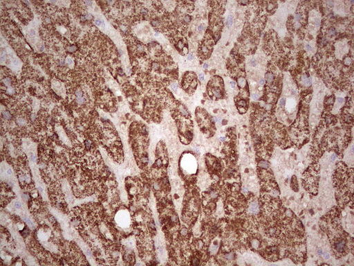 IHC of paraffin-embedded Human liver tissue using anti-ABAT mouse monoclonal antibody. (Heat-induced epitope retrieval by 1 mM EDTA in 10mM Tris, pH8.5, 120°C for 3min).