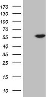 HEK293T cells were transfected with the pCMV6-ENTRY control (Left lane) or pCMV6-ENTRY ABAT (Right lane) cDNA for 48 hrs and lysed. Equivalent amounts of cell lysates (5 ug per lane) were separated by SDS-PAGE and immunoblotted with anti-ABAT.